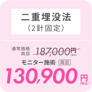 二重埋没法（2針固定）／モニター施術[両目]130,900円（税込）