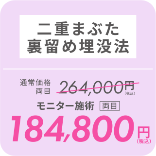 二重まぶた裏留め埋没法／モニター施術[両目]184,800円（税込）