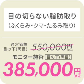 目の切らない脂肪取り（ふくらみ・クマ・たるみ取り）／モニター施術[目の下(両目)]385,000円（税込）