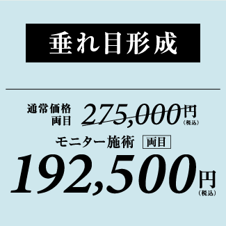 銀座高須クリニック/木・金曜日限定/部分モニターキャンペーン/垂れ目形成30%OFF