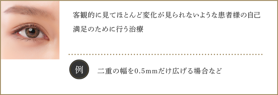 ・客観的に見てほとんど変化が見られないような患者様の自己満足のために行う治療【例】二重の幅を0.5mmだけ広げる場合など