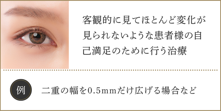 ・客観的に見てほとんど変化が見られないような患者様の自己満足のために行う治療【例】二重の幅を0.5mmだけ広げる場合など