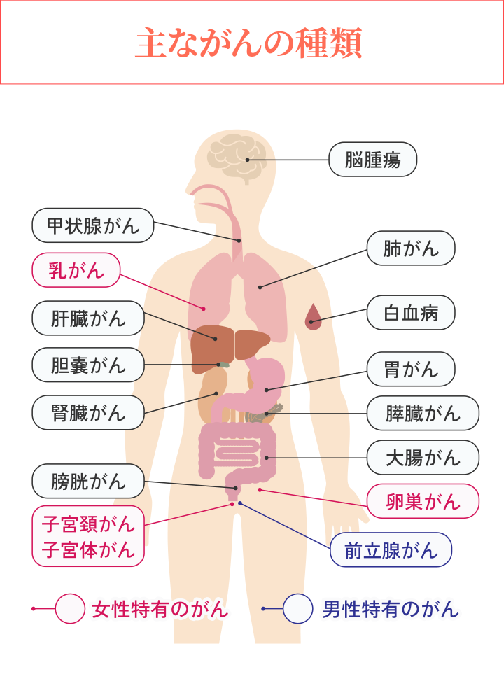 【主ながんの種類】甲状腺がん、肝臓がん、胆嚢がん、腎臓がん、膀胱がん、脳腫瘍、肺がん、白血病、胃がん、膵臓がん、大腸がん/<女性特有のがん>乳がん、子宮頸がん、子宮体がん、卵巣がん/<男性特有のがん>前立腺がん