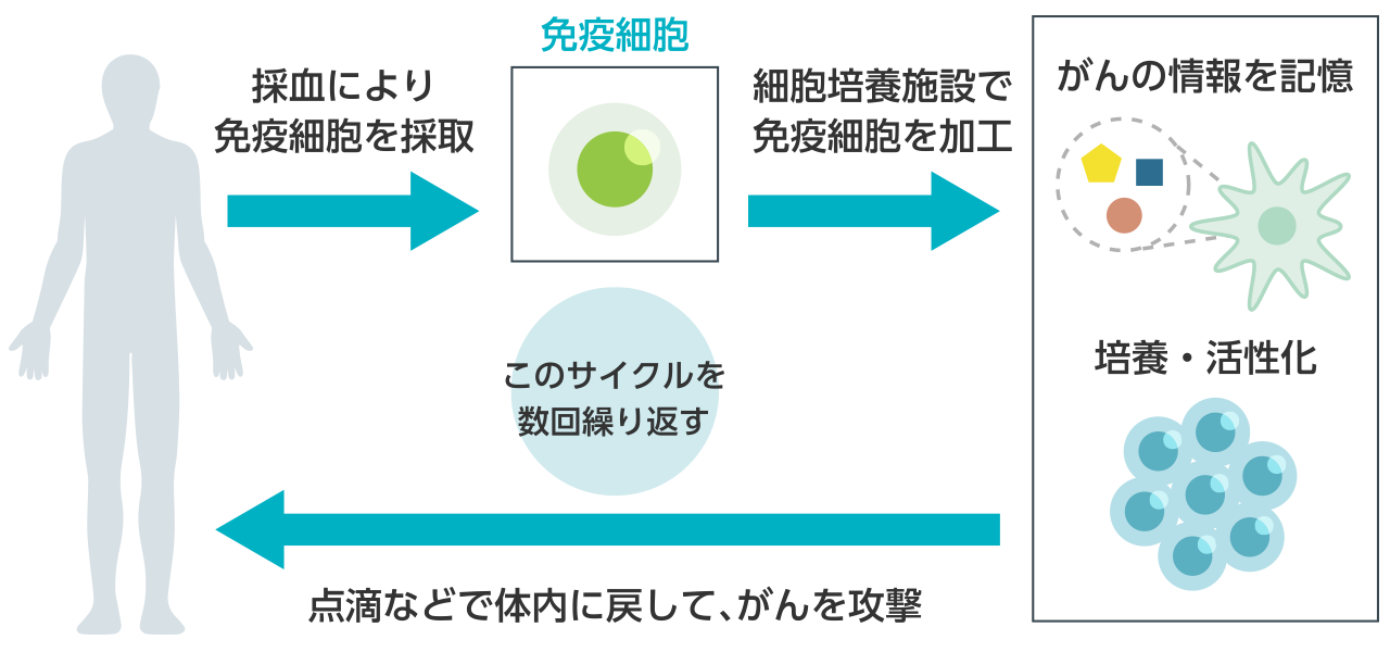 採血により免疫細胞を採取→【免疫細胞】→細胞培養施設で免疫細胞を加工→がんの情報を記憶(培養・活性化)→点滴などで体内に戻して、がんを攻撃/このサイクルを数回繰り返す