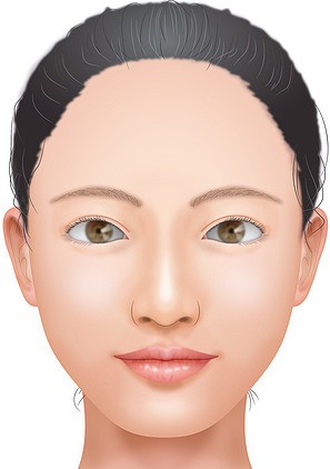 ウルセラシステム ： 肌（美容皮膚科）：美容外科 高須クリニック