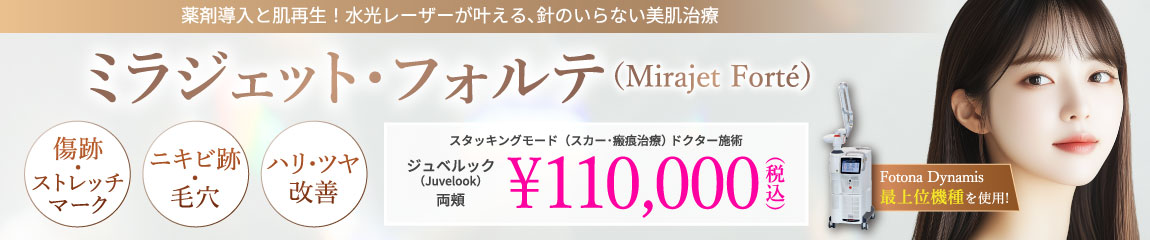 ミラジェット・フォルテ(Mirajet Forte)