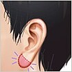 その他の耳の手術