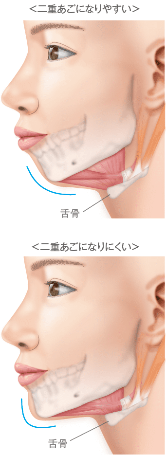 二重あご改善 あご 顎 輪郭 小顔 フェイスライン 美容整形の高須クリニック