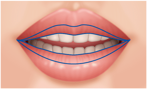 唇を薄く たらこ唇 口もと 口元 くちびる 唇 美容整形の高須クリニック