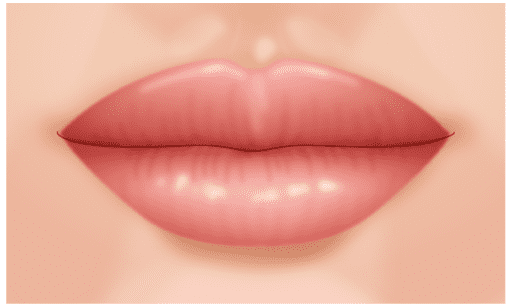 唇を薄く たらこ唇 口もと 口元 くちびる 唇 美容整形の高須クリニック