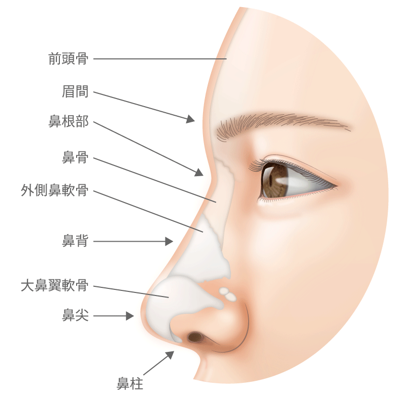 わし鼻 段鼻のハンプ切除で横顔まで美しく 高須クリニック