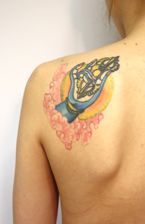 刺青（タトゥー）除去,肩の巨大な入れ墨を剝削手術で除去した20代女性の症例写真,Before,ba_irezumi039_b01.jpg