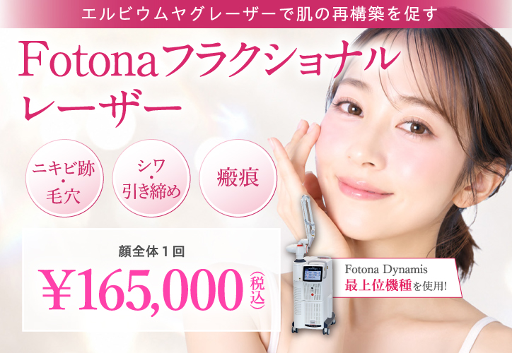 Fotonaフラクショナルレーザー
