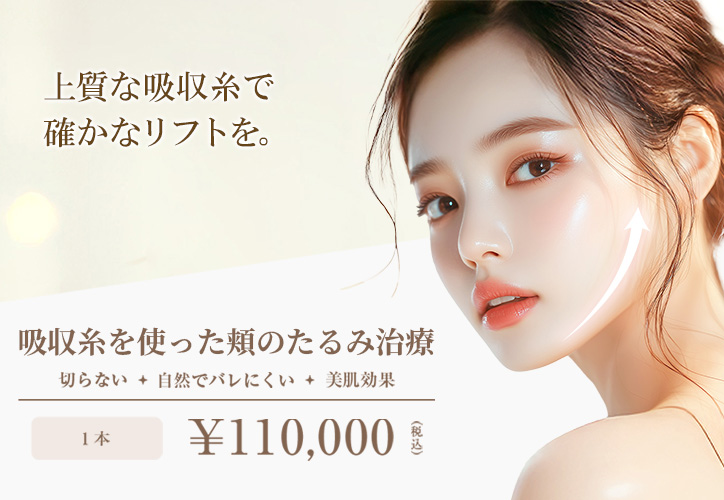 吸収糸を使った頬のたるみ治療/切らない・自然でバレにくい・美肌効果/1本 110,000円(税込)