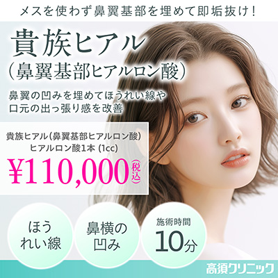 メスを使わず鼻翼基部を埋めて即垢抜け!/貴族ヒアル(鼻翼基部ヒアルロン酸)