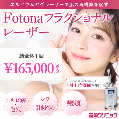 Fotonaフラクショナルレーザー