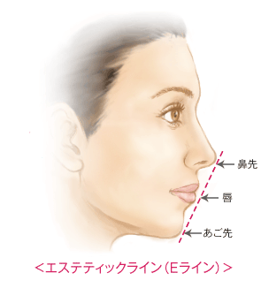 アゴにヒアルロン酸やプロテーゼを入れると 顔が長くなるのか Dr 高須幹弥の美容整形講座 美容整形の高須クリニック