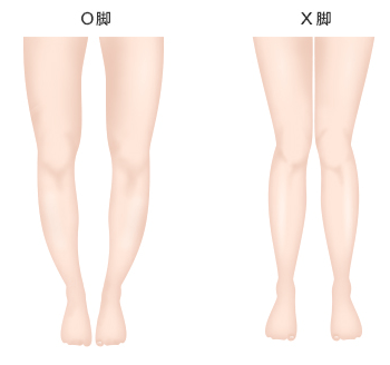 太ももの内側の脂肪を取ると 脚を閉じたときに必ず隙間はできるのか Dr 高須幹弥の美容整形講座 美容整形の高須クリニック