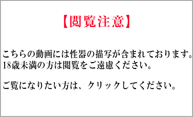 閲覧注意！小陰唇縮小・クリトリス包茎手術　術前局所麻酔注射　綺麗に整った女性器にします　長いので短くし、左右差を治します：MikiTube-症例紹介：美容外科 高須クリニック